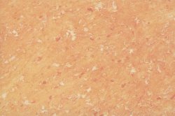 ������� �������� Parade Deco S70